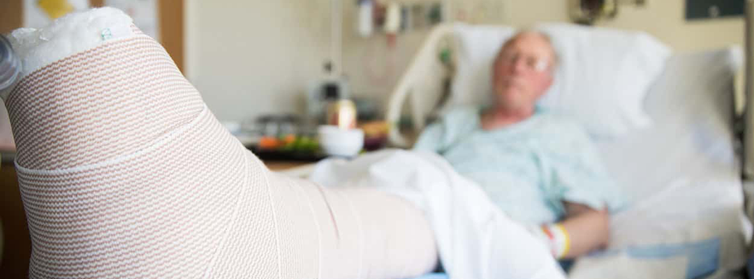 Most Common In-Home Injuries for the Elderly